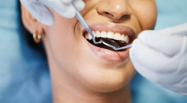 Best Urgent Care for Lost Fillings or Crowns in Pomona, NY